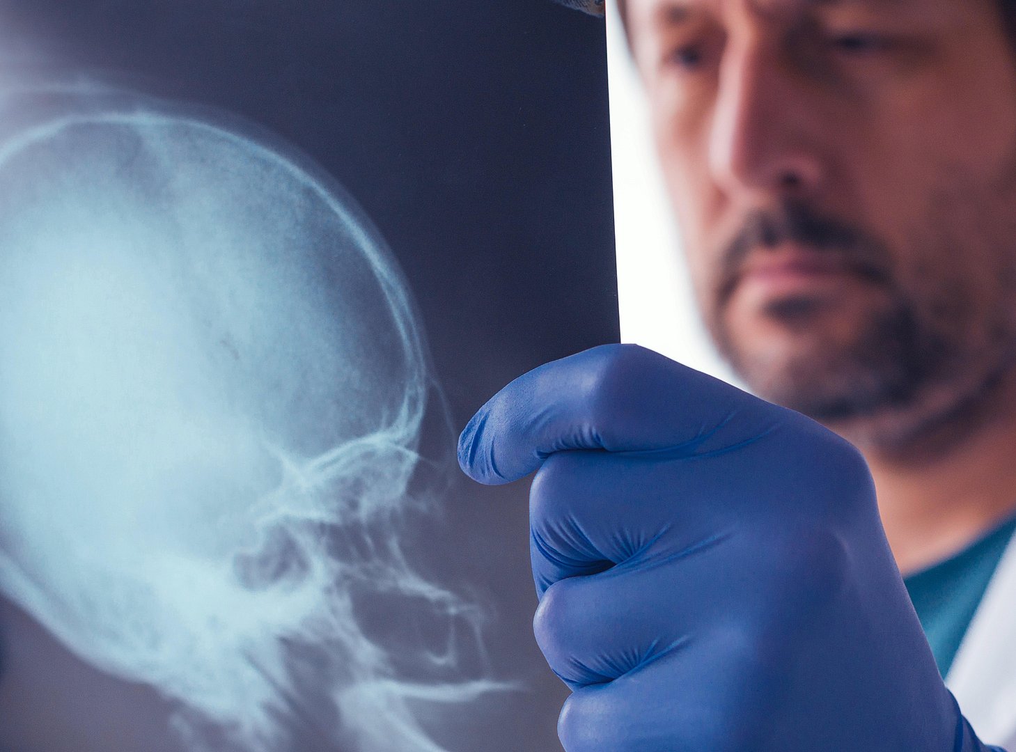 Understanding Head Entered Neglect: Causes and Prevention Tips